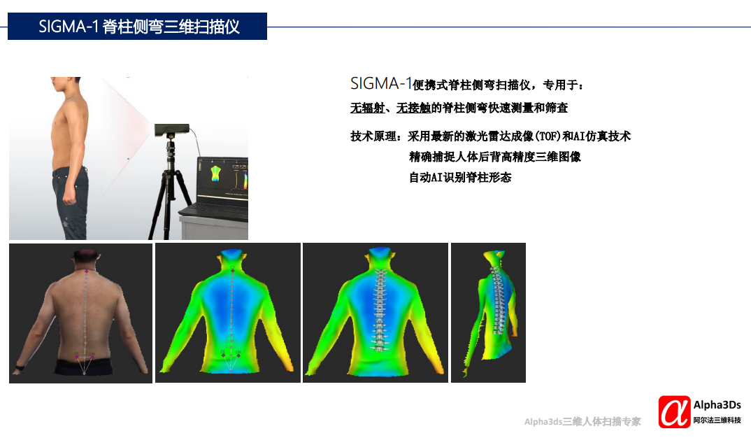 SIGMA-1 便攜式脊柱側(cè)彎三維掃描儀